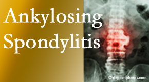 Ankylosing spondylitis is gently cared for by your Fernandina Beach chiropractor.