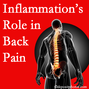 The role of inflammation in Fernandina Beach back pain is real. Chiropractic care can help.
