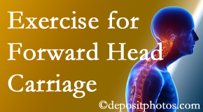 Fernandina Beach chiropractic treatment of forward head carriage is two-fold: manipulation and exercise.