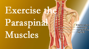 Amelia Chiropractic Clinic describes the importance of paraspinal muscles and their strength for Fernandina Beach back pain relief.