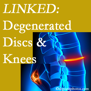 Degenerated discs and degenerated knees are not such strange bedfellows. They are seen to be related. Fernandina Beach patients with a loss of disc height due to disc degeneration often also have knee pain related to degeneration.  