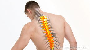 Fernandina Beach thoracic spine pain image 