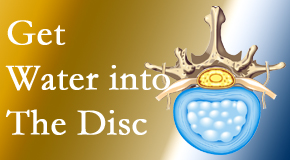 Amelia Chiropractic Clinic uses spinal manipulation and exercise to enhance the diffusion of water into the disc which helps the health of the disc.