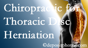 Amelia Chiropractic Clinic diagnoses and manages thoracic disc herniation pain and relieves its symptoms like unexplained abdominal pain or other gastrointestinal issues. 