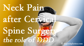 Amelia Chiropractic Clinic offers gentle treatment for neck pain after neck surgery.
