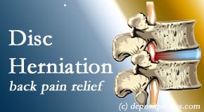 Amelia Chiropractic Clinic offers non-surgical treatment for relief of disc herniation related back pain. 