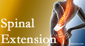 Amelia Chiropractic Clinic understands the role of extension in spinal motion, its necessity, its benefits and potential harmful effects. 