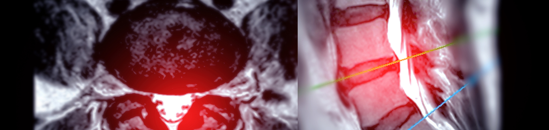Fernandina Beach back pain imaging and exercise