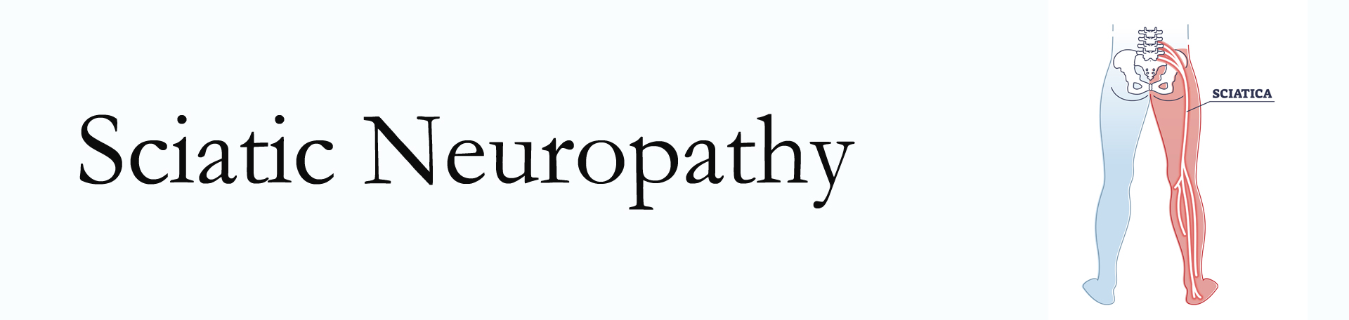 Fernandina Beach neuropathy pain (sciatica)