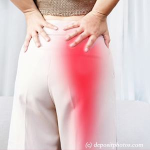 picture of Fernandina Beach leg pain, sciatica, lumbar radiculopathy