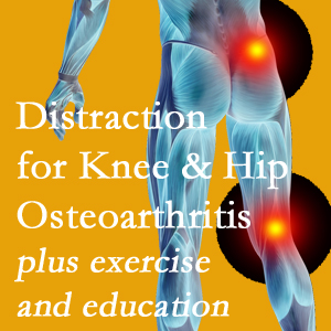 A chiropractic treatment plan for Fernandina Beach knee pain and hip pain due to osteoarthritis: education, exercise, distraction.