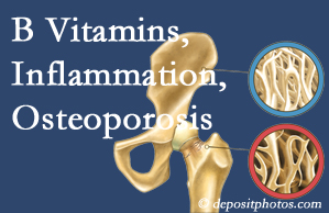 Fernandina Beach chiropractic care of osteoporosis often comes with nutritional tips like b vitamins for inflammation reduction and for prevention.