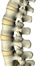 low back pain spine picture