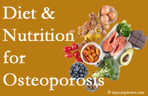 Fernandina Beach osteoporosis prevention tips from your chiropractor include improved diet and nutrition and reduced sodium, bad fats, and sugar intake. 