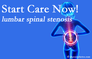 Amelia Chiropractic Clinic shares research that emphasizes that non-operative treatment for spinal stenosis within a month of diagnosis is beneficial. 